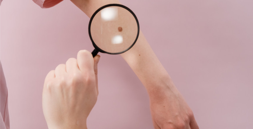 Portal de Not�cias PJF | Dia do dermatologista � comemorado neste s�bado, 05 | SS - 4/2/2022